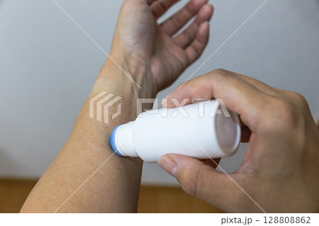 汗疹にかゆみ止めの薬を塗っている 128808862