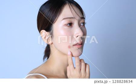 ニキビ　肌荒れに悩む女性イメージ 128828634
