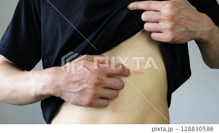 服をまくり体を掻く人物 服をまくり体を掻く人物 128830586