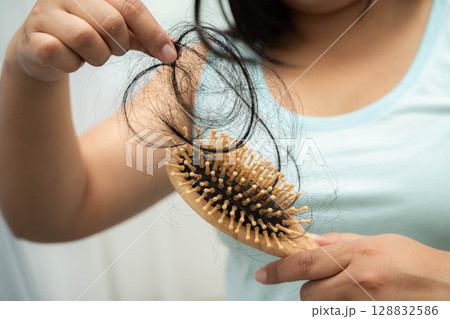 Asian woman have problem with long hair loss attach to comb brush. Asian woman have problem with long hair loss attach to comb brush. 128832586