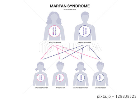Marfan syndrome poster Marfan syndrome poster 128838525