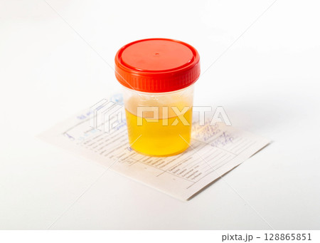 Medical direction on the table with a container of urine for analysis. Urine analysis for protein and bacteria, close-up. White background 128865851