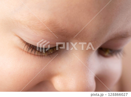 Pus in a little boy's eyes. Concept of bacterial and viral conjunctivitis in children, close-up 128866027