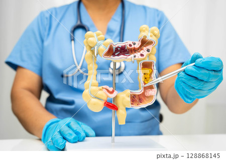 Intestine, Asian woman holding human anatomy model. Intestine, Asian woman holding human anatomy model. 128868145