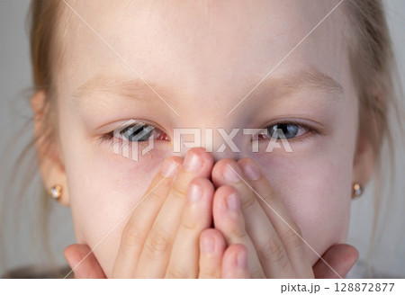 Caucasian girl aged 8 with sad painful look looks at camera, close-up, portrait. Disease concept Caucasian girl aged 8 with sad painful look looks at camera, close-up, portrait. Disease concept 128872877