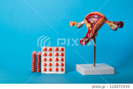 Stack of red pills on background of gynecological model and blue background. Concept of antifungal, hormonal and contraceptive pills in gynecology. Copy space for text 128872930
