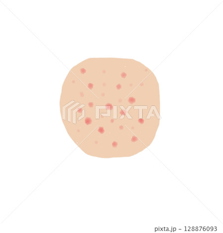 発疹｜皮膚に現れる点状変化のイラスト素材（透過PNG）Rash Skin Illustration 128876093