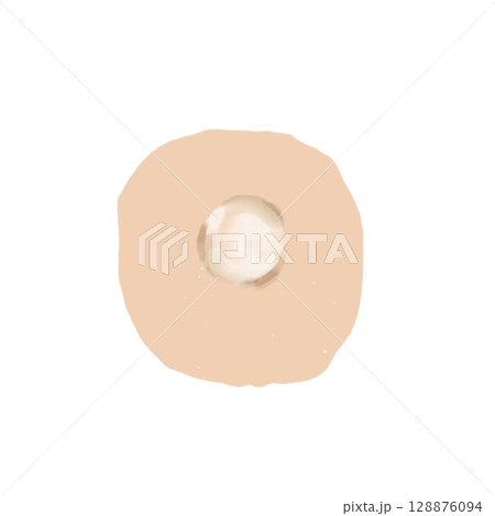 水疱｜皮膚の水ぶくれイラスト素材（透過PNG）Blister / Vesicle Illustrat 128876094