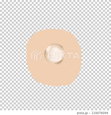 水疱｜皮膚の水ぶくれイラスト素材（透過PNG）Blister / Vesicle Illustrat 128876094