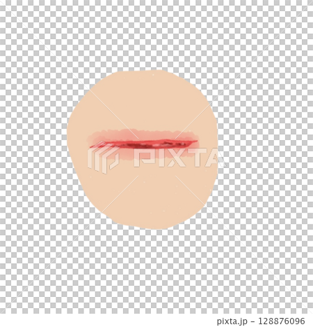 裂傷｜皮膚の裂けた創傷イラスト素材（透過PNG）Laceration Wound Illustrat 128876096