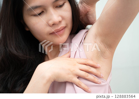Asian woman have problem black armpit beauty skin care. 128883564
