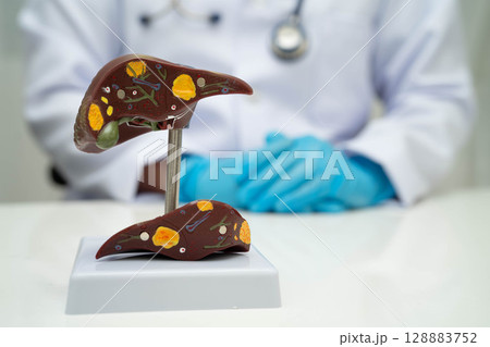 Liver with gallbladder, pancreas spleen and duodenum, Asian doctor holding human anatomy model for study diagnosis and treatment in hospital. 128883752