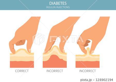 Diabetes. Endocrine diseases. Medical infographic design Diabetes. Endocrine diseases. Medical infographic design 128902194