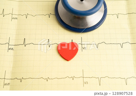 Stethoscope on electrocardiogram ECG, heart wave, heart attack, cardiogram report. Stethoscope on electrocardiogram ECG, heart wave, heart attack, cardiogram report. 128907528