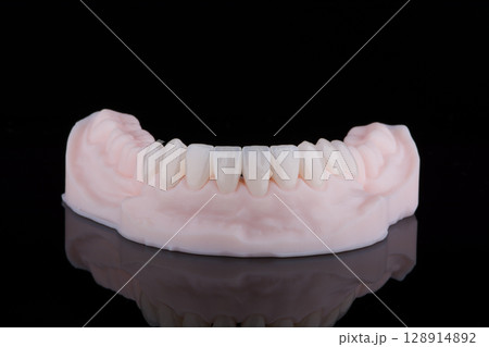 Quality dental zirconium crowns of lower jaw stylized as young bright teeth on 3D printed model. Quality dental zirconium crowns of lower jaw stylized as young bright teeth on 3D printed model. 128914892