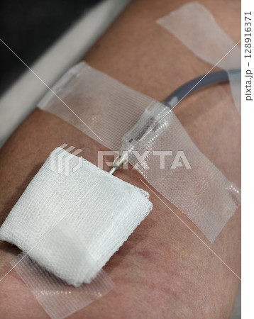 Arm with Cotton and Tape After Blood Donation. Close-Up View Arm with Cotton and Tape After Blood Donation. Close-Up View 128916371