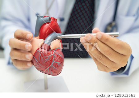 Cardiovascular disease CVD, Asian doctor holding human anatomy model for learn and treat heart disease. 129012563
