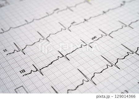 Red heart on electrocardiogram ECG with red heart, heart wave, heart attack, cardiogram report. Red heart on electrocardiogram ECG with red heart, heart wave, heart attack, cardiogram report. 129014366
