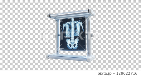 X-Ray Film Viewer With Human Skeleton Image. Medical Imaging And Diagnostic Tool Isolated On Transparent Background 129022716