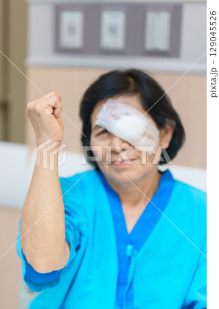 Elderly Woman with eye protective shield after eye surgery. Eye disease, Cataract,  Glaucoma, Age Related Macular Degeneration, Diabetic Retinopathy, Vitreous, Lasik, World Glaucoma day and health 129045526