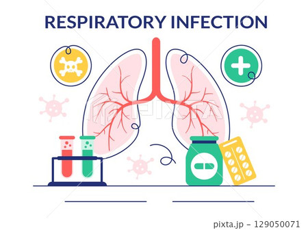 Vector Illustration of Respiratory Infection and Inflammation in the Lungs Caused by Virus Cells in a Healthcare and Medical Concept Background 129050071