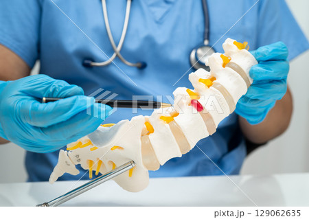 Asian doctor holding spinal nerve and bone model, Lumbar spine displaced herniated disc fragment for treatment medical in the orthopedic department. 129062635