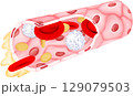 Blood Vessel and Cell Components 129079503