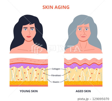 Aging process skin. Young, old woman portrait, structure changes, wrinkles, epidermis dehydration, elasticity loss, cartoon isolated female face, dermatology poster nowaday vector concept 129095070