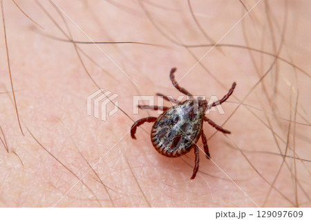a tick crawls mite on a person's arm, close-up, macro 129097609