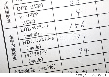 健康診断のコレステロール異常。LDL高値HDL低値の血液検査結果。 健康診断のコレステロール異常。LDL高値HDL低値の血液検査結果。 129135981