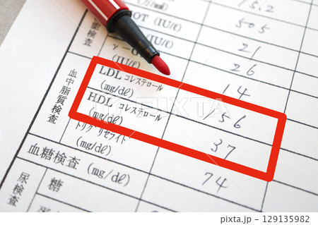 健康診断のコレステロール異常。LDL高値HDL低値の血液検査結果。 129135982