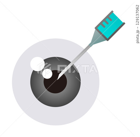 老化や疾患による目の病気になり眼科で手術をして治療するイラスト 129137062