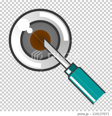 Illustration of eye disease caused by aging or disease, treated by surgery at an ophthalmology clinic Illustration of eye disease caused by aging or disease, treated by surgery at an ophthalmology clinic 129137071