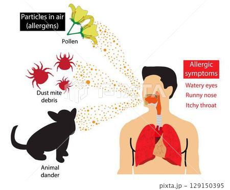 illustration of medical and Pollution, Symptoms of airborne allergies, Particles in air allergies, Allergies are caused by air poisoning from pollen and dust mites 129150395