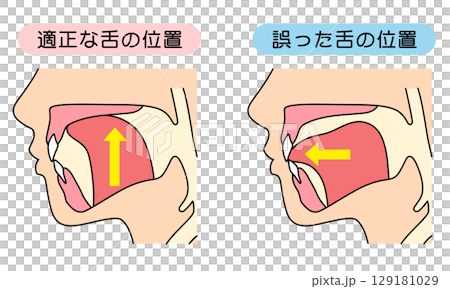 How to mew properly: correct and incorrect tongue position 129181029