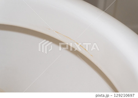 洋式トイレ 便器の縁についた尿石 129210697