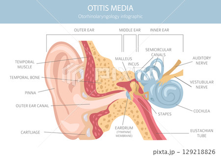Otitis media. Infection in the middle ear. Otological disorders infographic 129218826