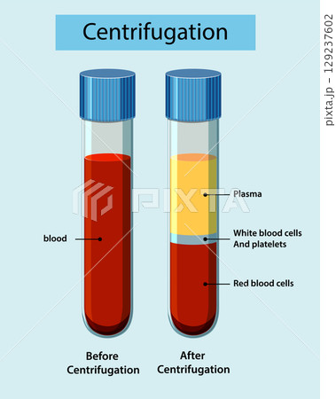 Blood Separation in Test Tubes by Centrifugation Blood Separation in Test Tubes by Centrifugation 129237602