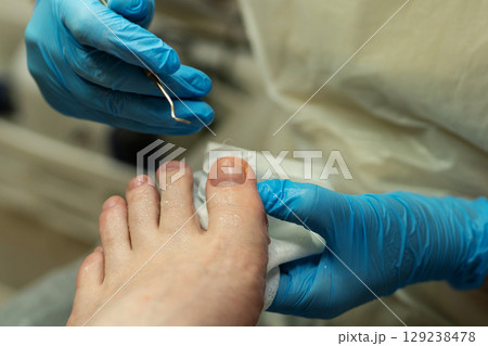 Detail view of toenail cleaning with probe during pedicure session. 129238478