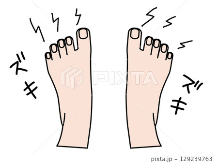 ズキズキと痛みを感じている両足 129239763
