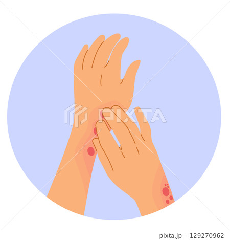 Cartoon Vector of Female Hands Scratching Skin Rash Illustration 129270962