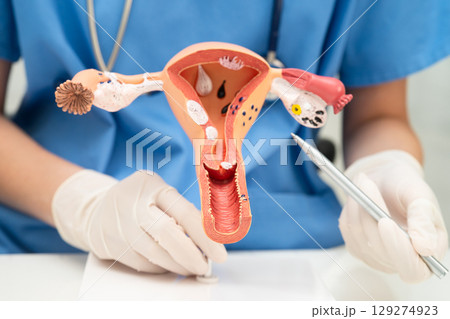 Uterus, doctor holding human anatomy model for study diagnosis and treatment in hospital. Uterus, doctor holding human anatomy model for study diagnosis and treatment in hospital. 129274923