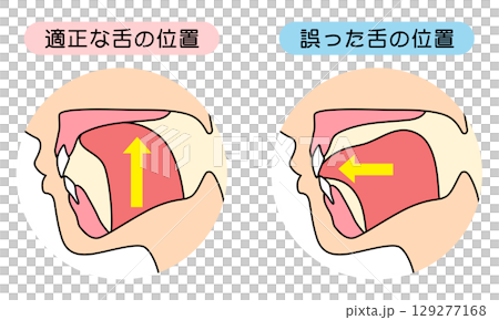 How to mew properly: correct and incorrect tongue position 129277168