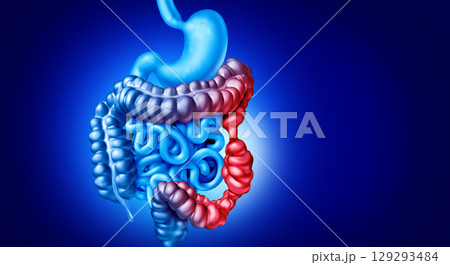 IBS Symptoms 129293484