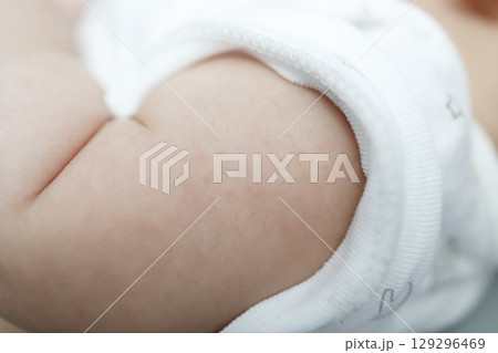 BCG予防接種翌日の赤ちゃんの腕の注射跡の様子 129296469