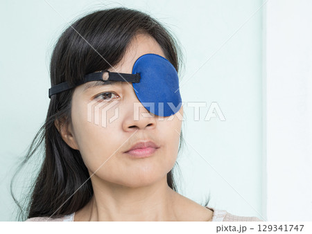 Woman Eye patch Pterygium Surgery Eye Medical Health Protection Wind and Sunshine, Medicine Care Patient After Pterygium Excision of Doctor Oculist Hospital,Old Human Problem Vision Disease Lens Iris. Woman Eye patch Pterygium Surgery Eye Medical Health Protection Wind and Sunshine, Medicine Care Patient After Pterygium Excision of Doctor Oculist Hospital,Old Human Problem Vision Disease Lens Iris. 129341747