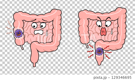 大腸がん 大腸がん 129346695