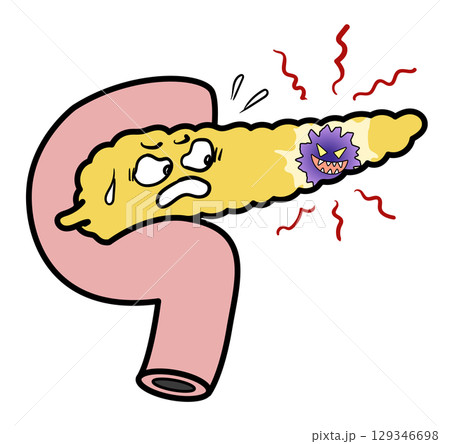 すい臓がん 129346698