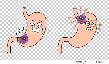 stomach cancer stomach cancer 129346699