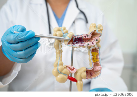 Intestine, doctor holding human anatomy model for study diagnosis and treatment in hospital. 129368006